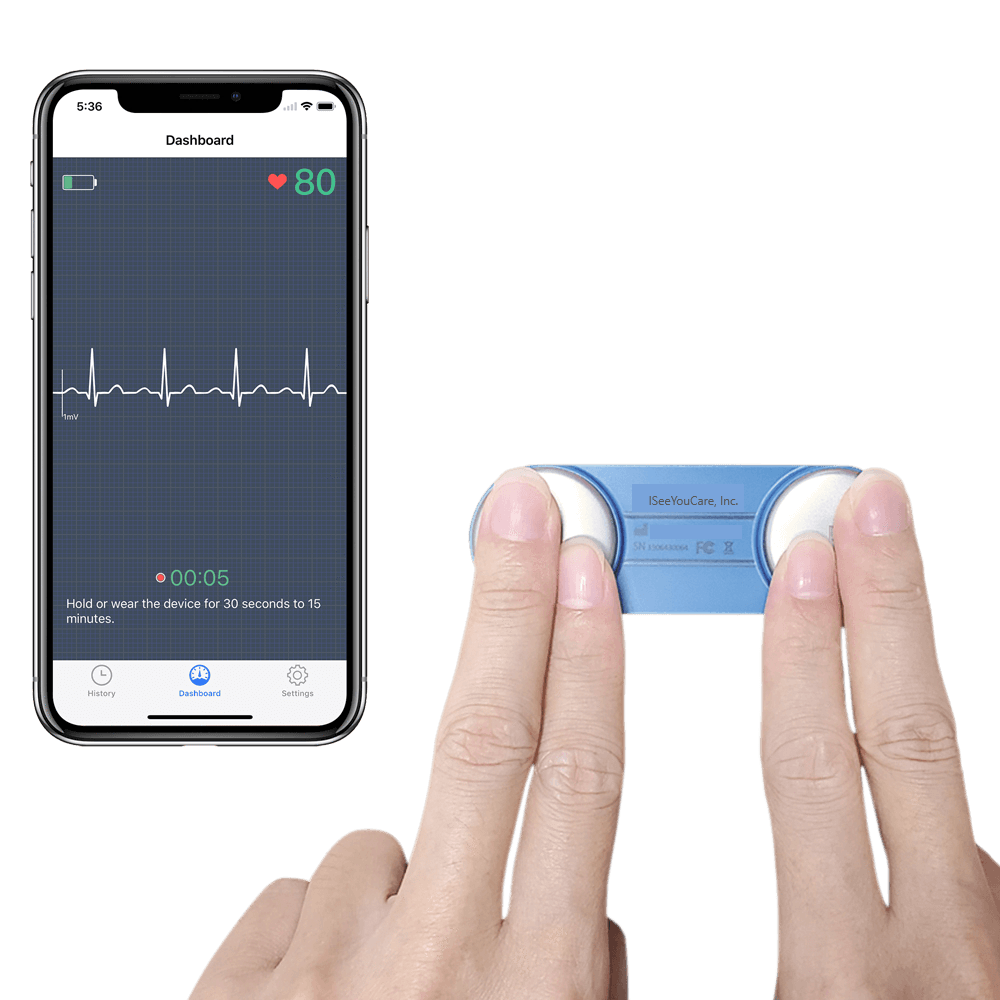 Wearable Mobile EKG/ECG Monitor